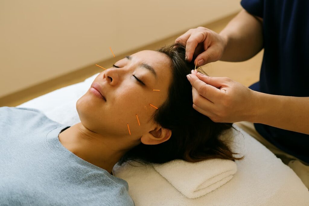 堺市で美容鍼をしている施術風景