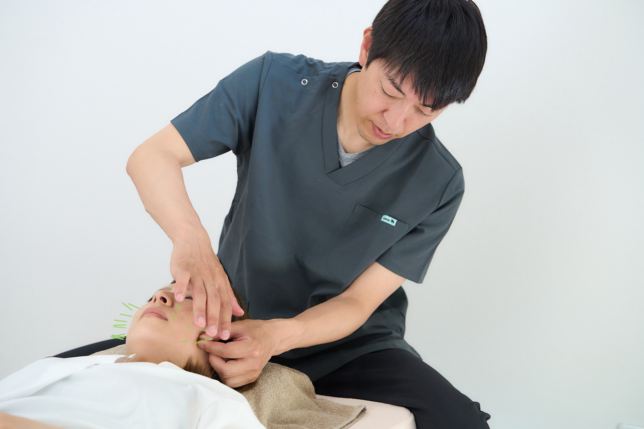 堺市で美容鍼の施術を行う様子